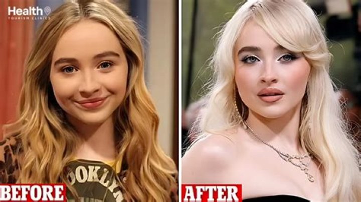 Sabrina Carpenter Surgery